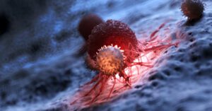 White_blood_cell_cancer 1
