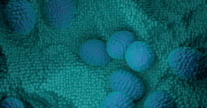 prostate_cancer